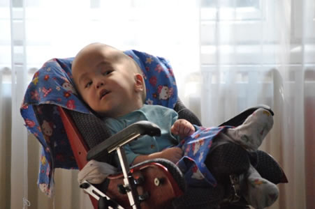 Rustam lives in a foster home. He was abandoned at birth by his parents… He was diagnosed with malfunction of the brain, and hydranencephaly at the stage of decompensation.
